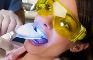 blanqueamiento dental 