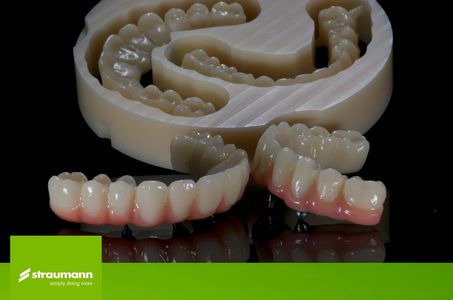 arcada completa en zirconia