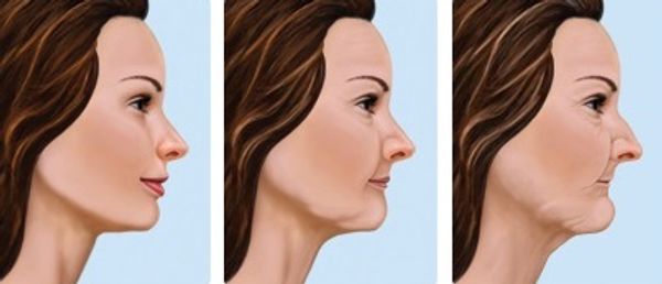 cambios morfológicos a partir de la perdida de piezas dentales