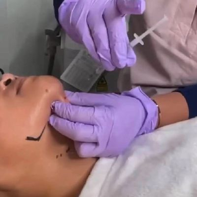 Person receiving injection in the chin area.