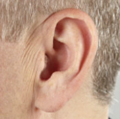 ear