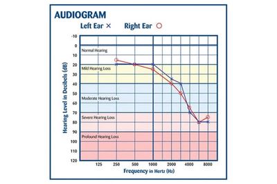 example of Audiogram