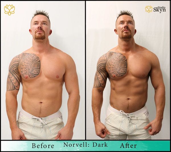 A male client's before and after photo.