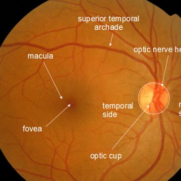Medical management of eye disease