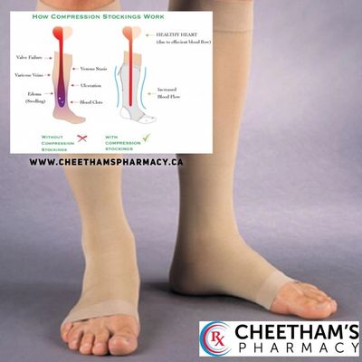 Keeping Your Legs Healthy with Compression Stockings  - Cheetham's Pharmacy - Saskatoon