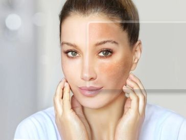 a young women with beautiful skin, but on one side it's red and bumpy