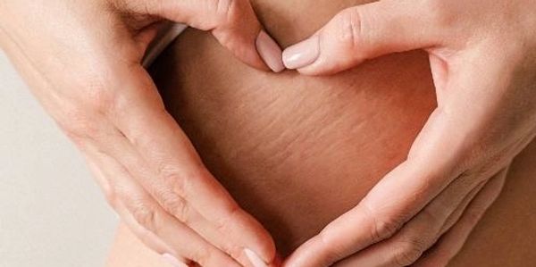 Hands forming a heart shape over a belly with stretch marks.