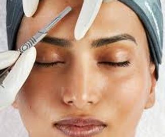 Dermaplaning is a cosmetic procedure that involves using a sterile surgical scalpel to gently scrape