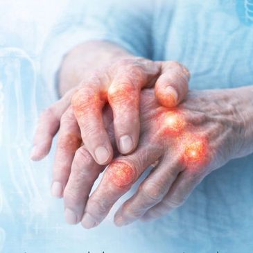 Rheumatoid arthritis