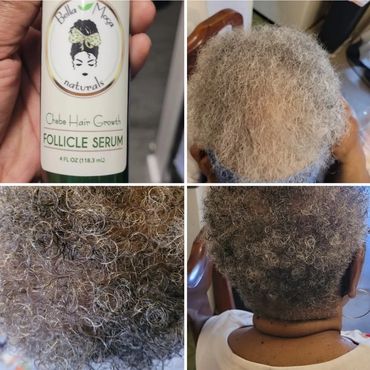 80 yr old client hair grew and reverted to black after using tthe Chebe hair growth system .