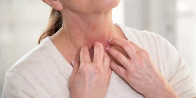 A woman with dry skin on her neck scratching it.