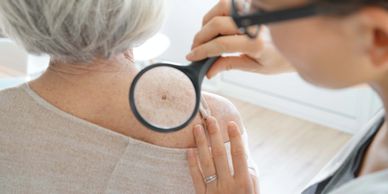 An elderly woman getting a mole looked at on her shoulder.