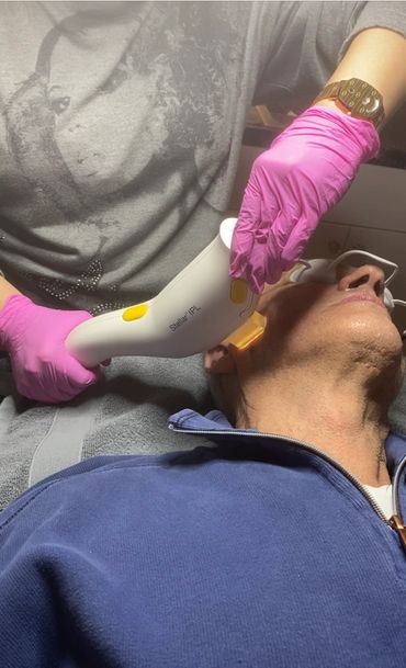 A man getting IPL or intense pulse light laser treatment for wrinkles, freckles & keratosis