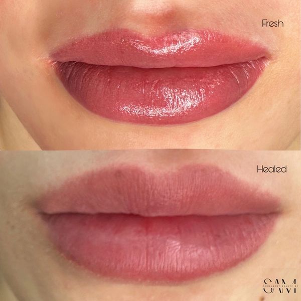 Fresh vs. Healed Lip Blush