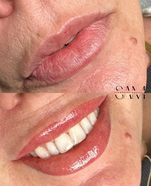 Before and after picture of lip blush