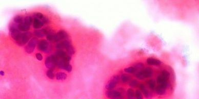 Breast Cancer Research