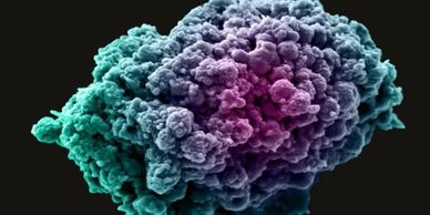 Breast Cancer Cells