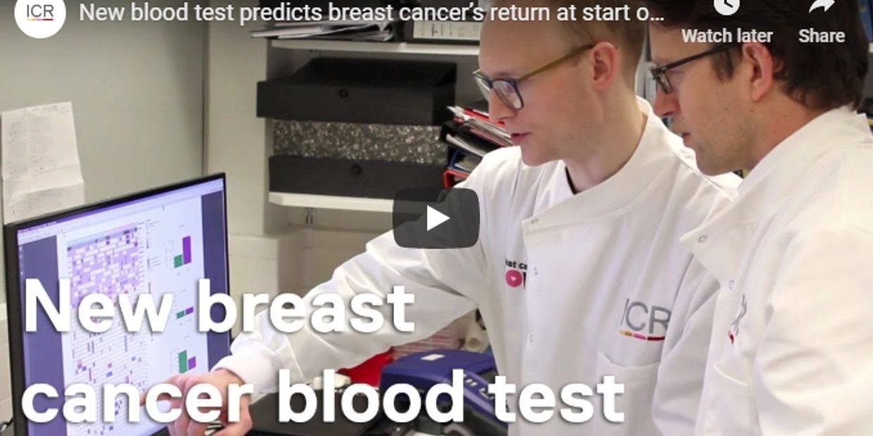 Breast Cancer Research