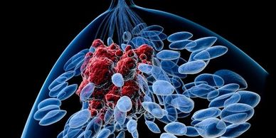 Breast cancer cells