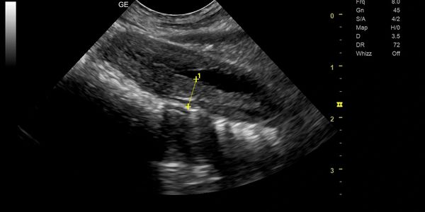 Ultrasound image obtained at Palivet clinic
