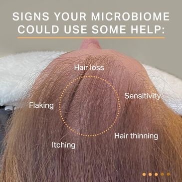 Keravive scalp health signs include hair loss, thinning, flaking.