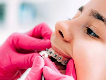 Close-up of a dentist adjusting braces on a smiling patient's teeth.