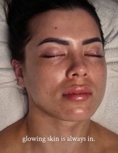 An after photo of a client after having the Intermediate Facial at UpGrace Paradise Point, Near Hope