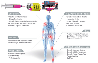 Stem, cell therapy, treatment, doctor clinic Bethesda, Maryland stem cell joint injections for pain