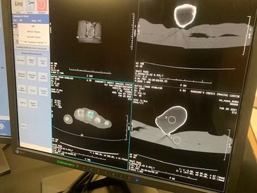 CT Scan of 3D printed foot bone FibreTuff