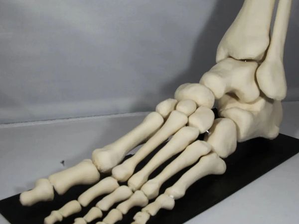 3D Printed foot