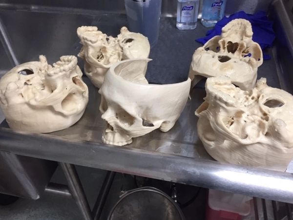 3D Printed Skulls made with FibreTuff PAPC