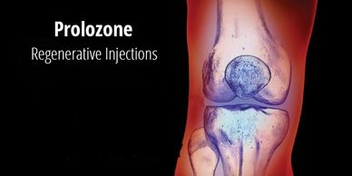 Prolozone Injections, Ozone Injections