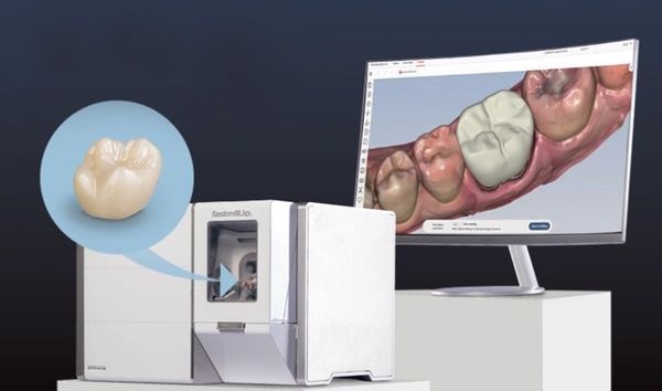 Montrose DDS does Same day crowns in houston texas