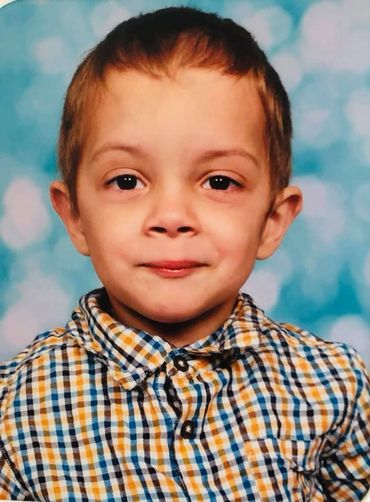 Vein of Galen Malformation (VOGM/VGM) boy in his school picture.