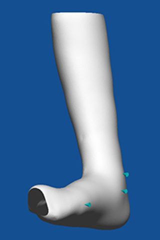 O&P in Motion Custom bracing solutions Ankle Foot Orthosis (AFO) Process