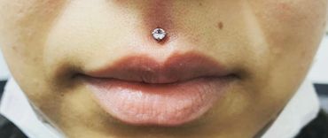 Fresh medusa piercing with a sparkling gemstone stud. A bold and symmetrical piercing.