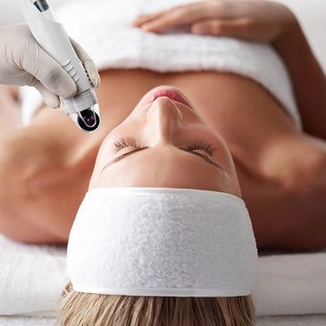 microneedling san antonio at the fountain of youth spa