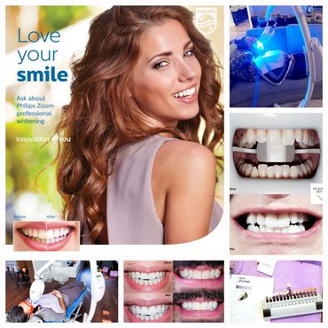 Philips Zoom teeth whitening collage with client photos, Monica Cordova of VitaliTeeth Dental