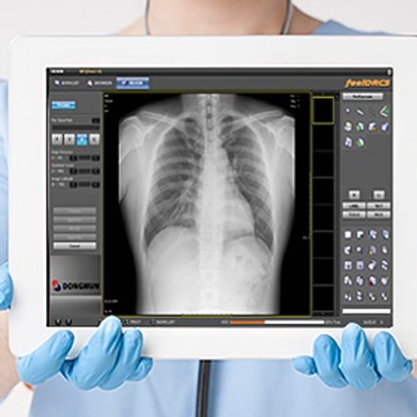 Medical professional holding a tablet showing a chest X-ray image.