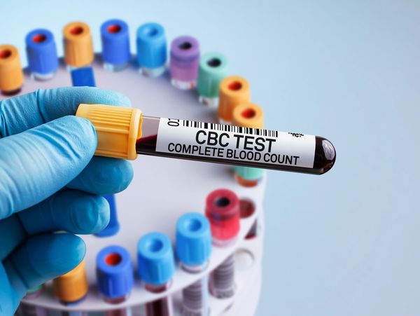 Gloved hand holding a blood sample labeled CBC test for complete blood count.