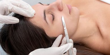 Dermaplaning Newton, MA