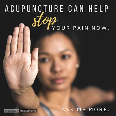 Acupuncture can stop pain