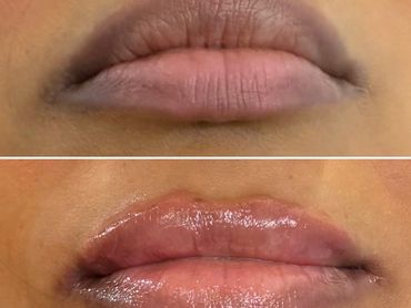 Polynucleotide transformation