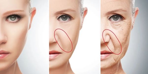 Surrey Botox® Clinic, by Dr. Ward. Botox®, Juvéderm® Fillers, CoolSculpting®, SkinMedica®, SkinVive™