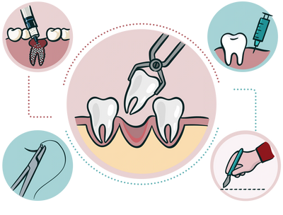 Tooth extraction. Local anesthesia. Bone graft. Surgical incision and suture.