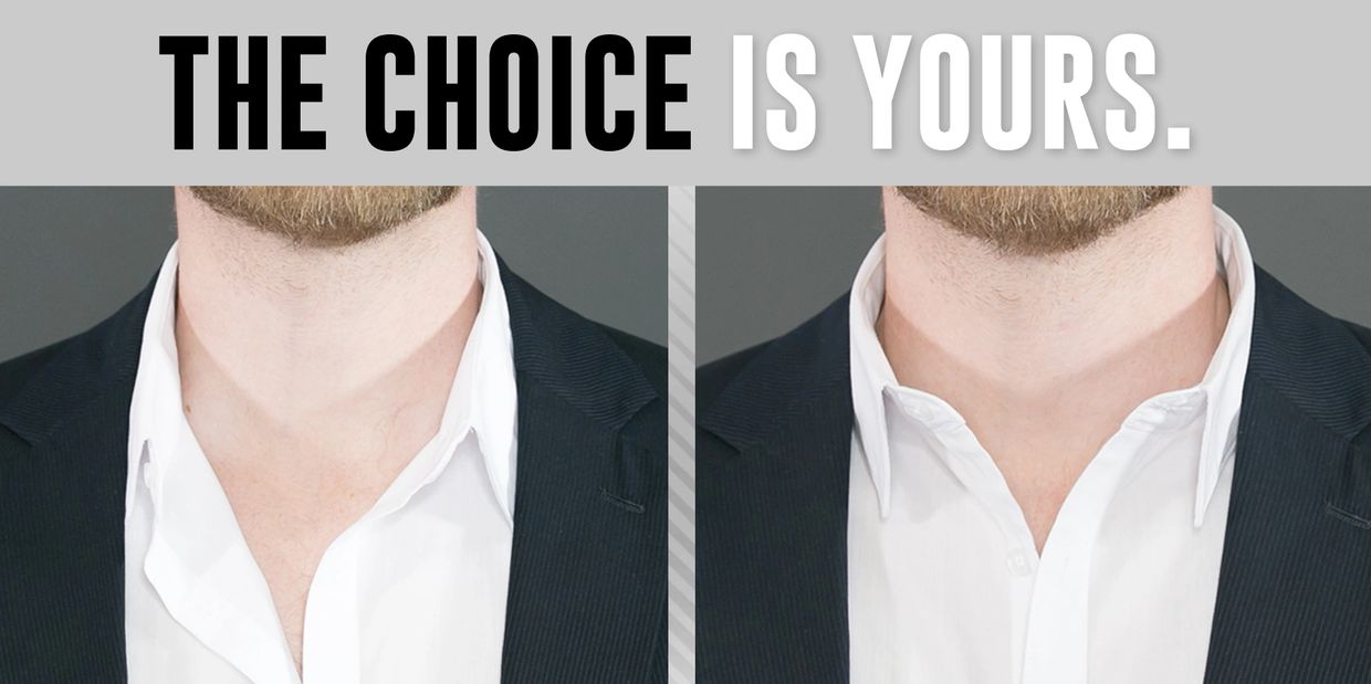The choice is yours; floppy collar vs. sturdy "Million Dollar Collar" at a a tailor near you.
