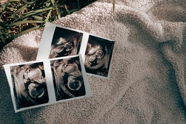 Ultrasound images placed on a textured blanket outdoors with grass nearby.