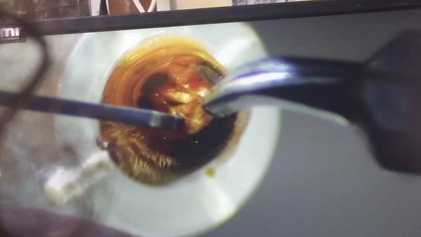 Prepping for instrumental insemination