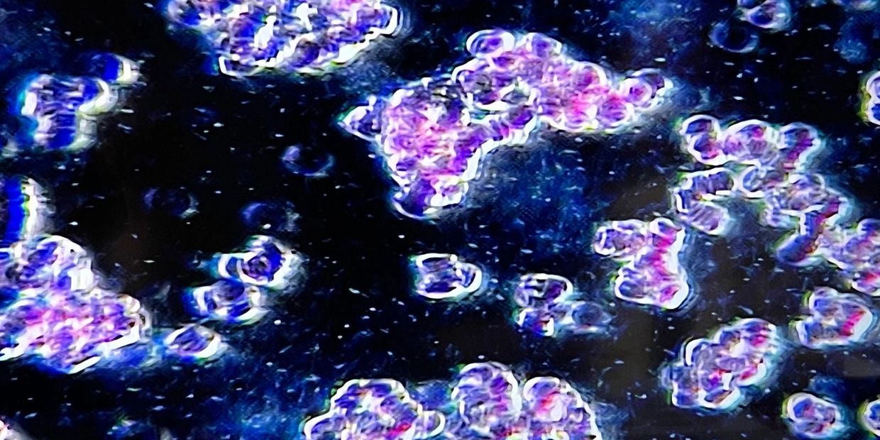 Microscopic view of a live blood analysis.