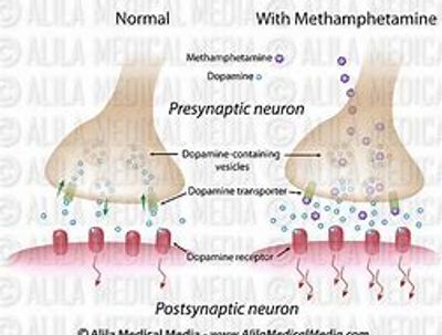 Amphetamine enters the  cell and pushes dopamine into the synapse stimulating the target cells